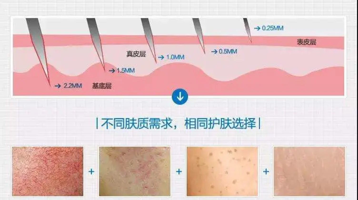 灰蛊_灰蛊风暴_灰蛊风暴是什么