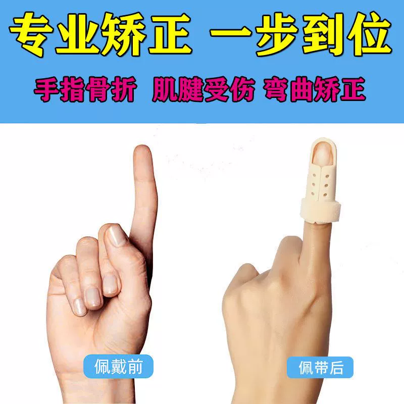 手机游戏手指矫正_手指矫正器_手指矫正器的制作视频