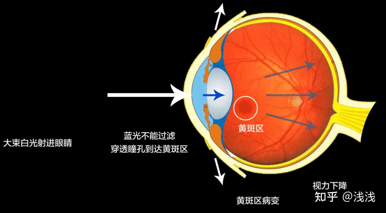 手游伤眼睛_手机游戏眼睛坏了_眼睛太难了游戏