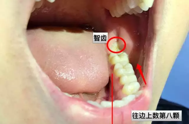 电影智齿_电影智齿深度解析_电影智齿豆瓣